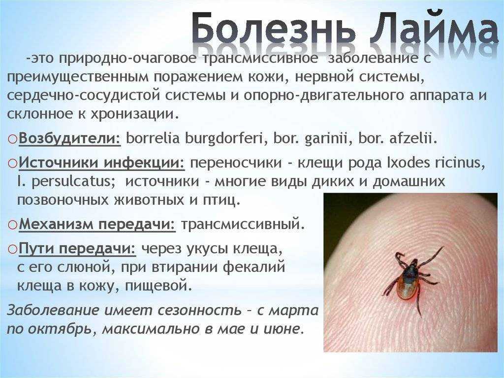 Склеродермия