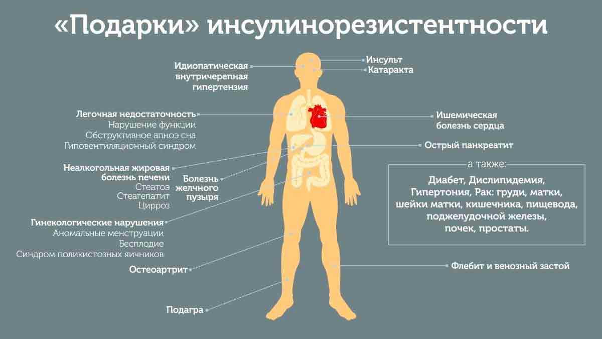 Пигментная ксеродерма