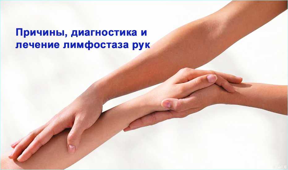 Лимфостаз – симптомы и лечение