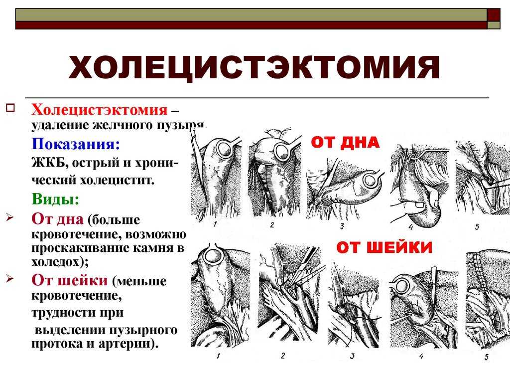 Презентация жкб терапия