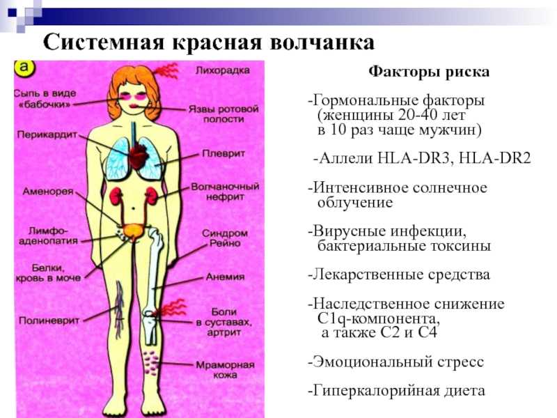 Системная красная