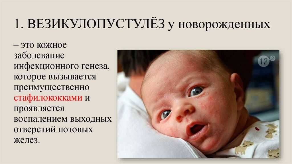 Везикулопустулез. причины, симптомы и лечение