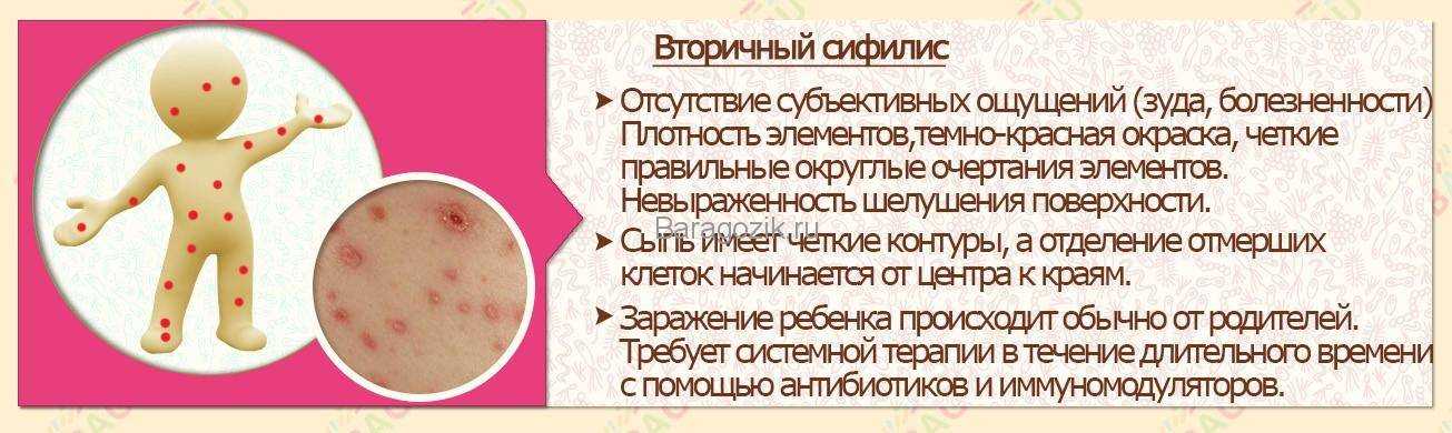 Красный плоский лишай — симптомы, диагностика, лечение * клиника диана в санкт-петербурге