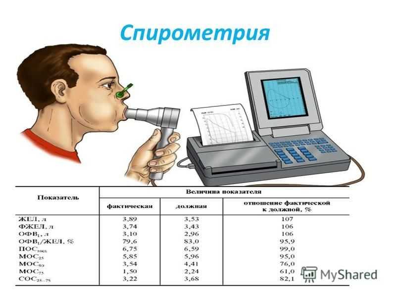 Пройти спирографию