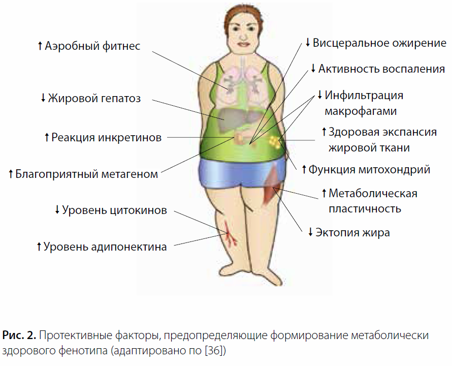 Признаки ожирения