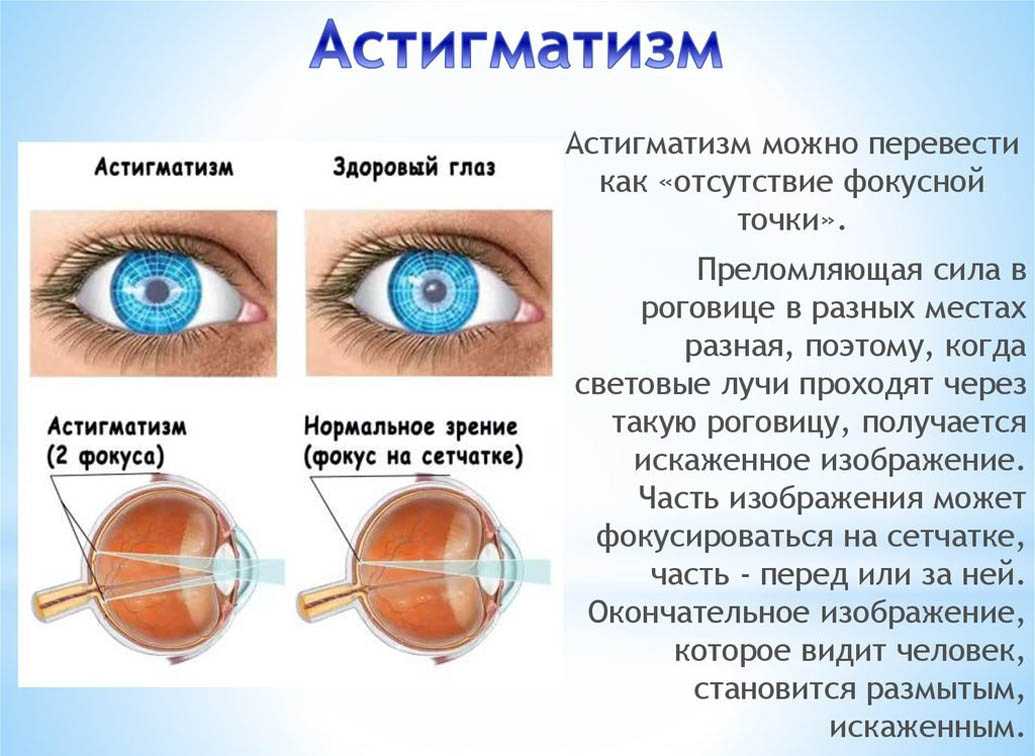 Дегенеративно-дистрофические заболевания позвоночника (ддзп)
