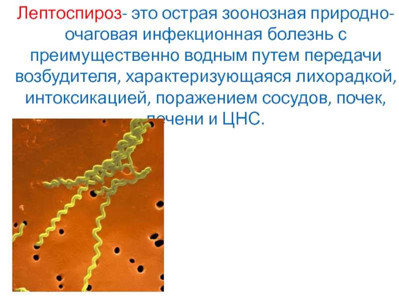 Лептоспироз