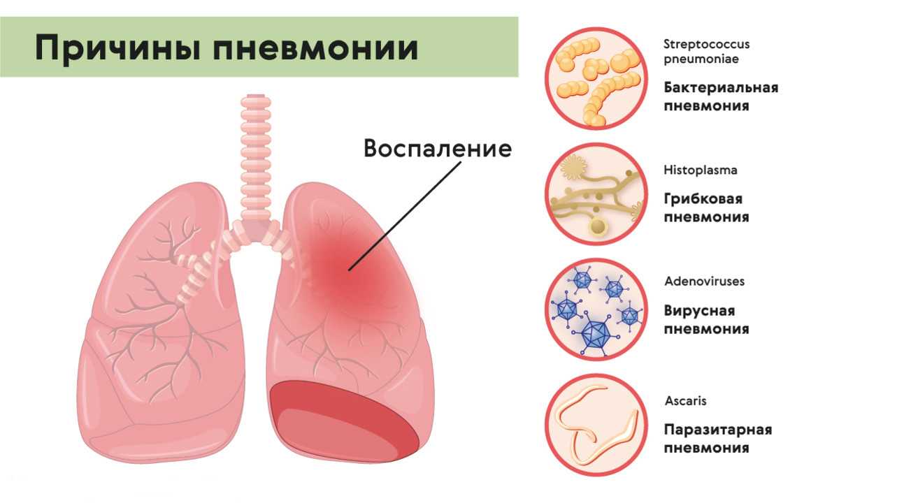 Информация о диетическом питании в санаториях европы и россии – виды диет, показания, номерные диеты и столы