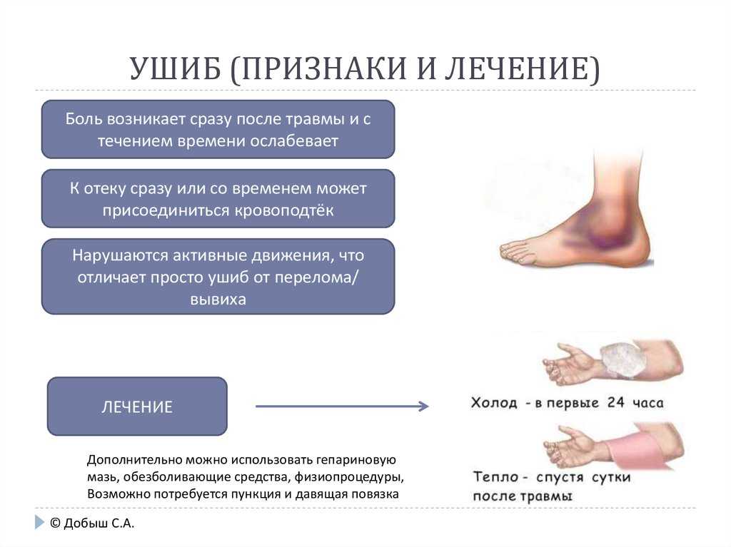 Посттравматический артрит сустава: симптомы, причины и лечение