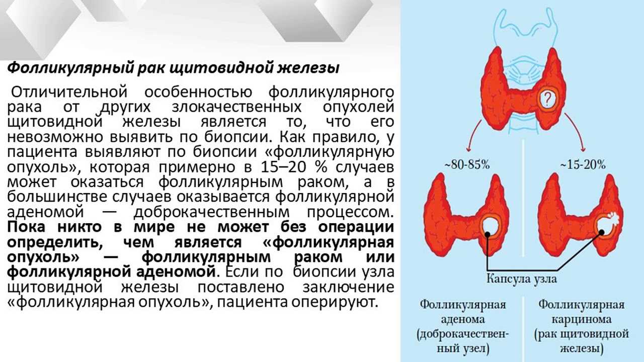 Что необходимо знать о кистах – lifekorea.ru