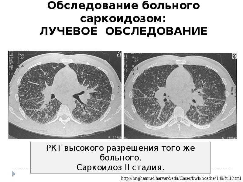 Газета «новости медицины и фармации» аллергология и пульмонология (454) 2013 (тематический номер)