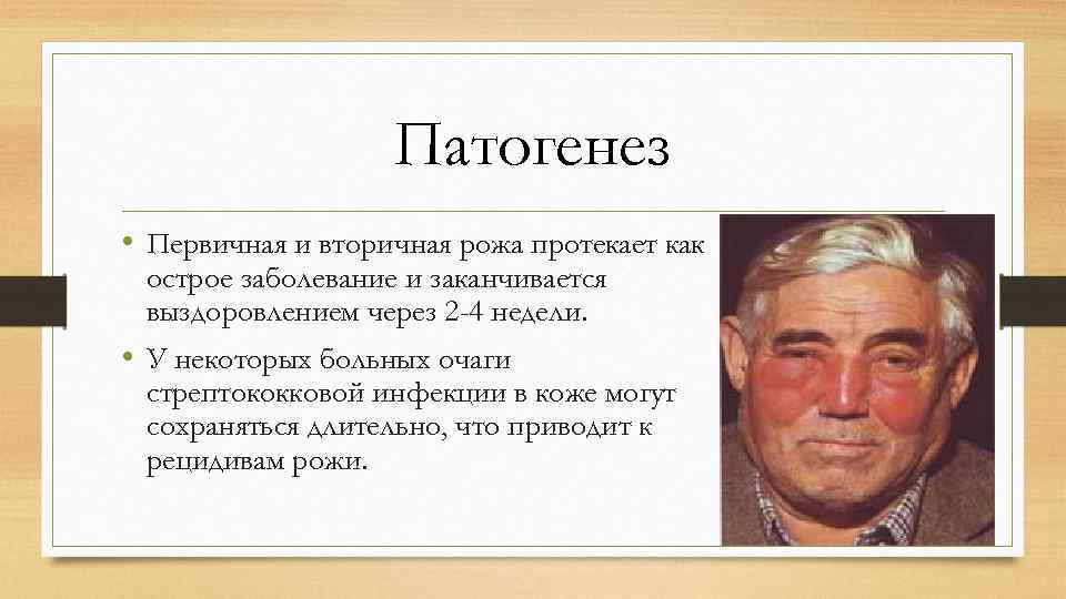 ᐈ рожа: симптомы и признаки ~【лечение в киеве】