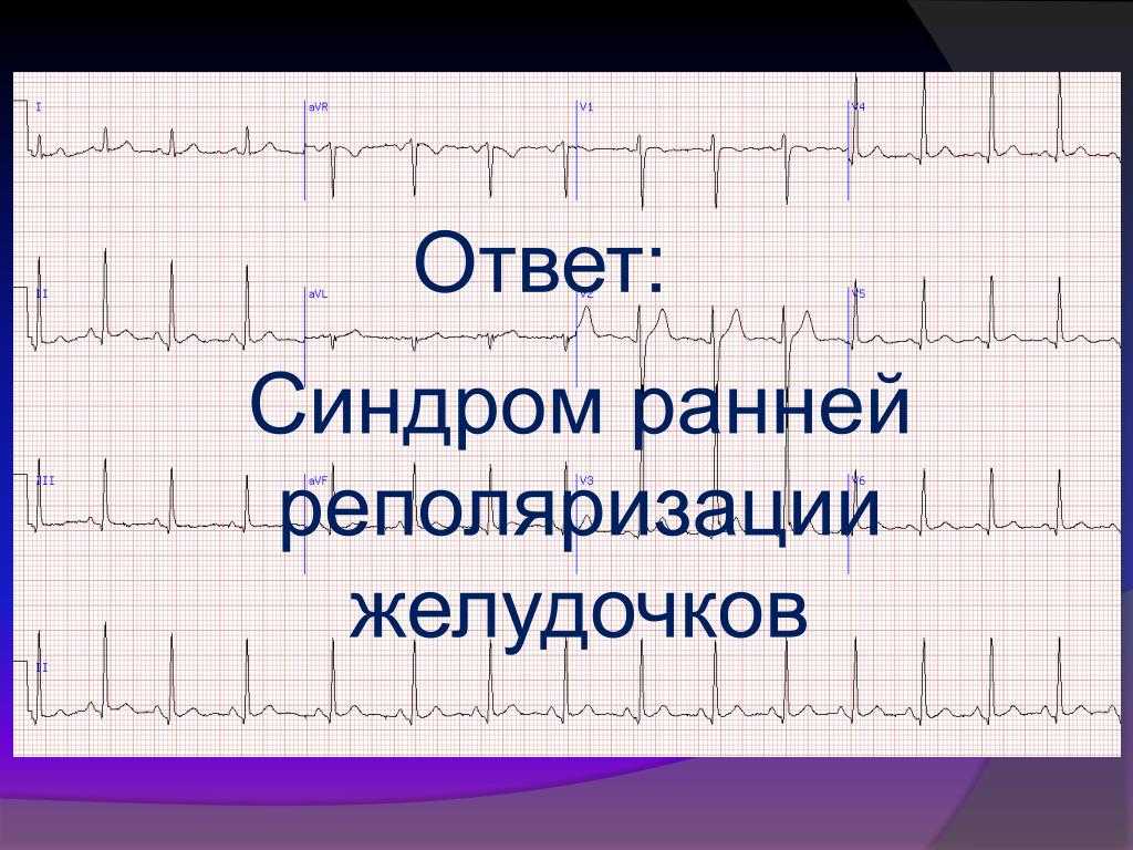 Синдром clc