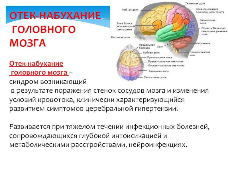 Отек и набухание головного мозга при инфекционных заболеваниях презентация