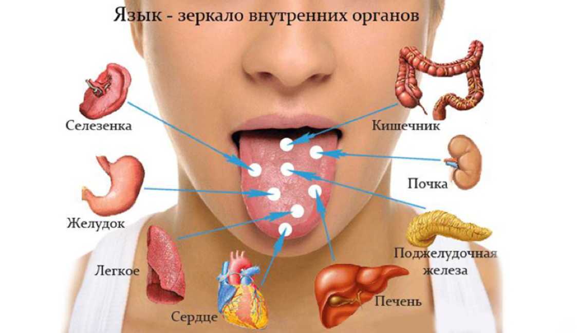 Болезни по языку схема налету