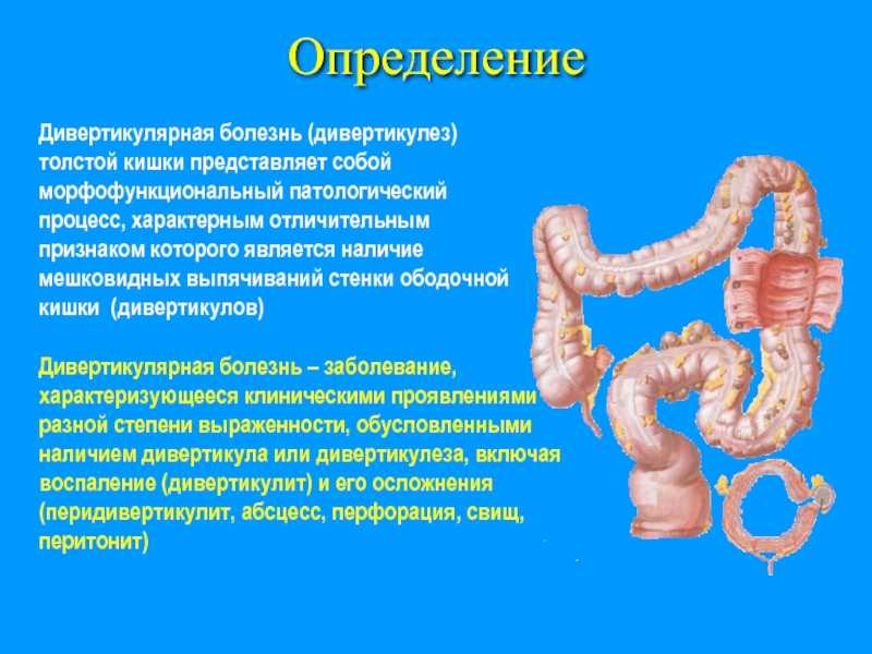 Диетический стол №3 (хронические заболевания кишечника)