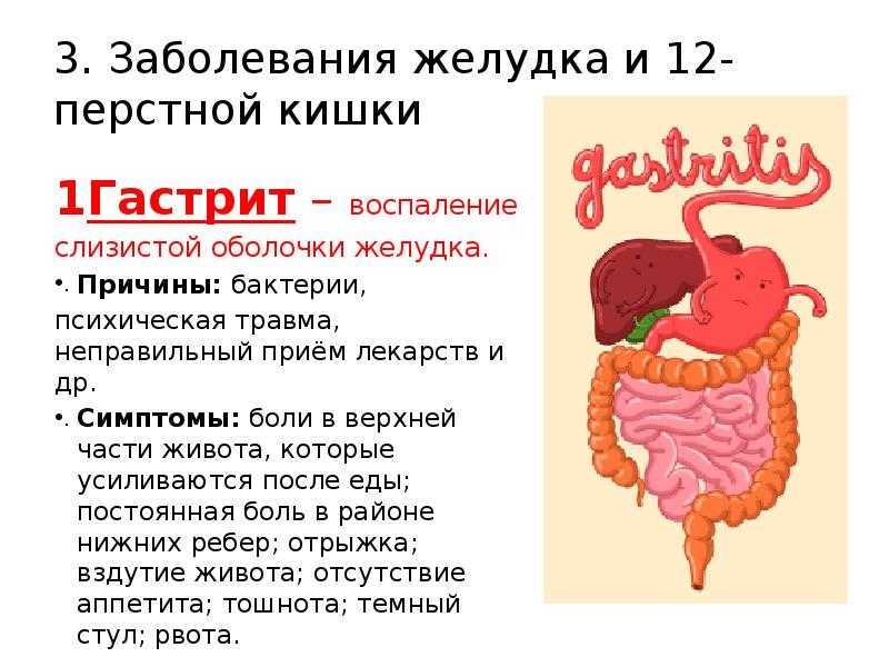Болезнь крона: симптомы, лечение, осложнения, диагностика у взрослых