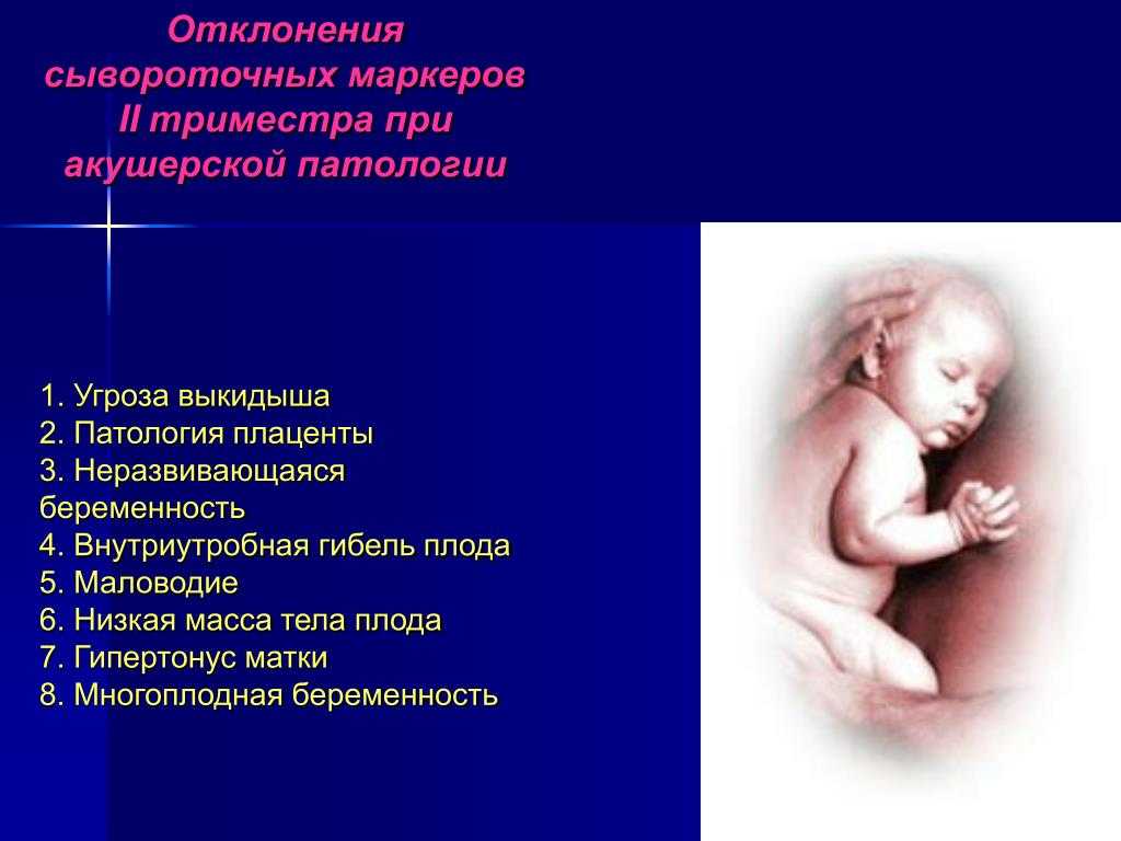 Внутриутробная гибель плода
