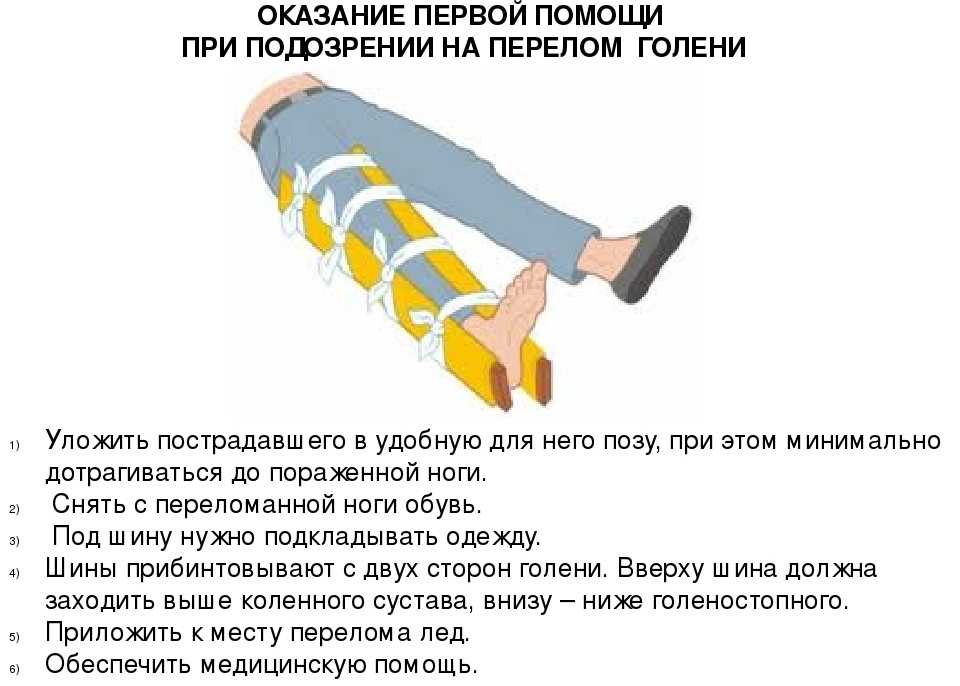 Несовершенный остеогенез