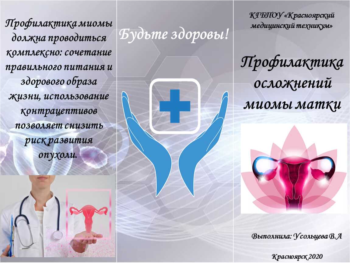 Миома матки