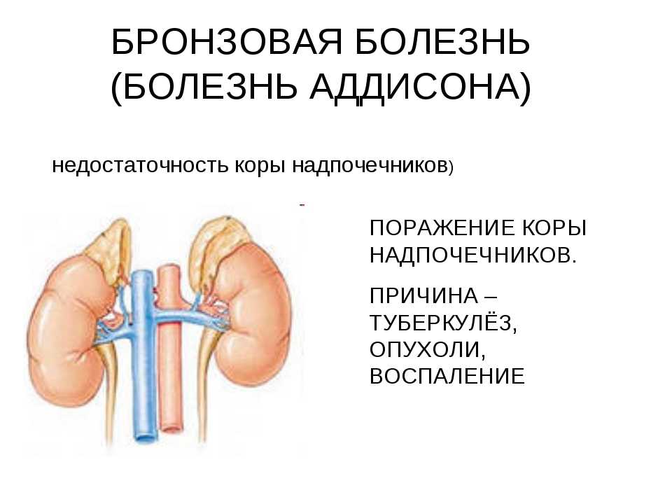 Хроническая надпочечниковая недостаточность