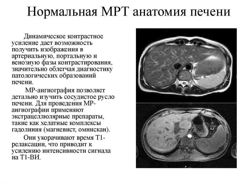 Рак печени мрт