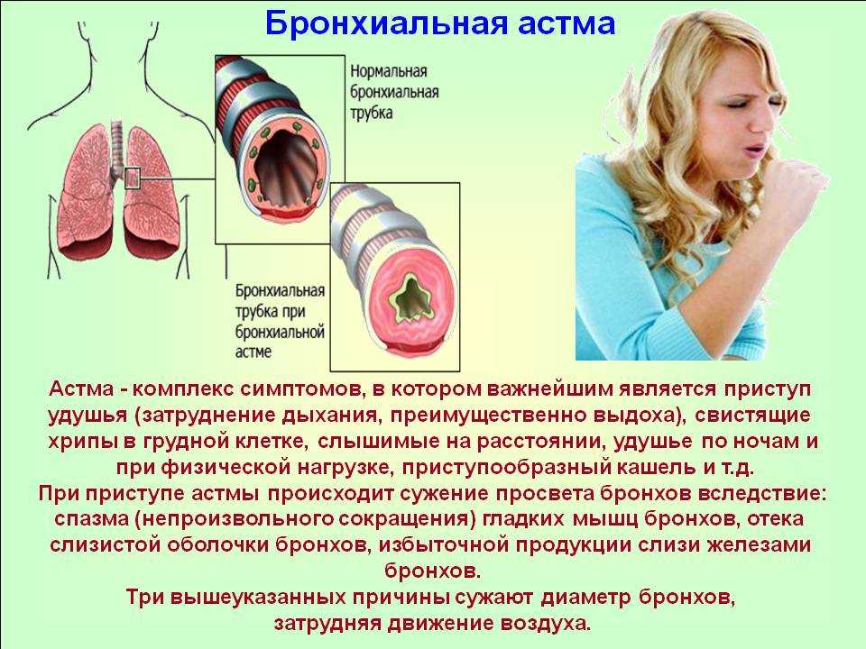 Острый обструктивный ларингит аускультативная картина