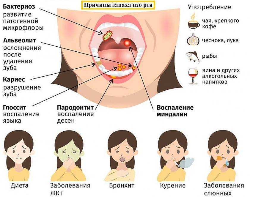 Жжение во рту, почему щиплет язык – причина, лечение