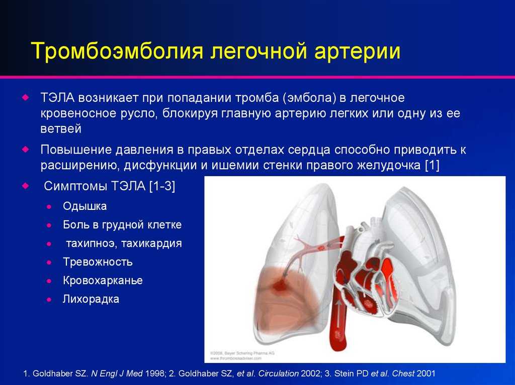 Тэла презентация лечение