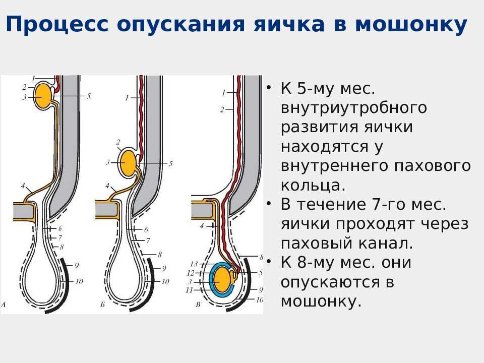 Диагностика перекрута яичка на снимках кт и мрт мошонки