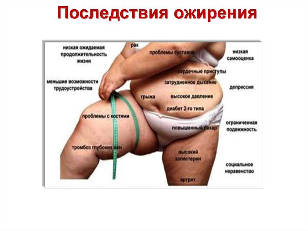 Лечебная диета №1: меню, продукты, рецепты | food and health