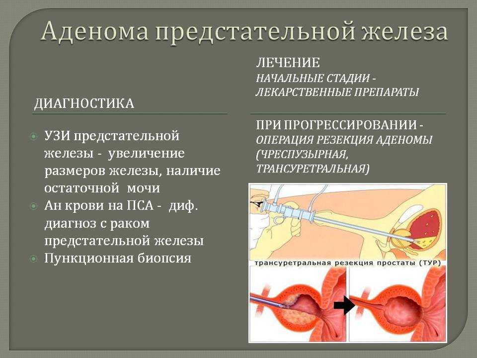 Рецидив аденомы