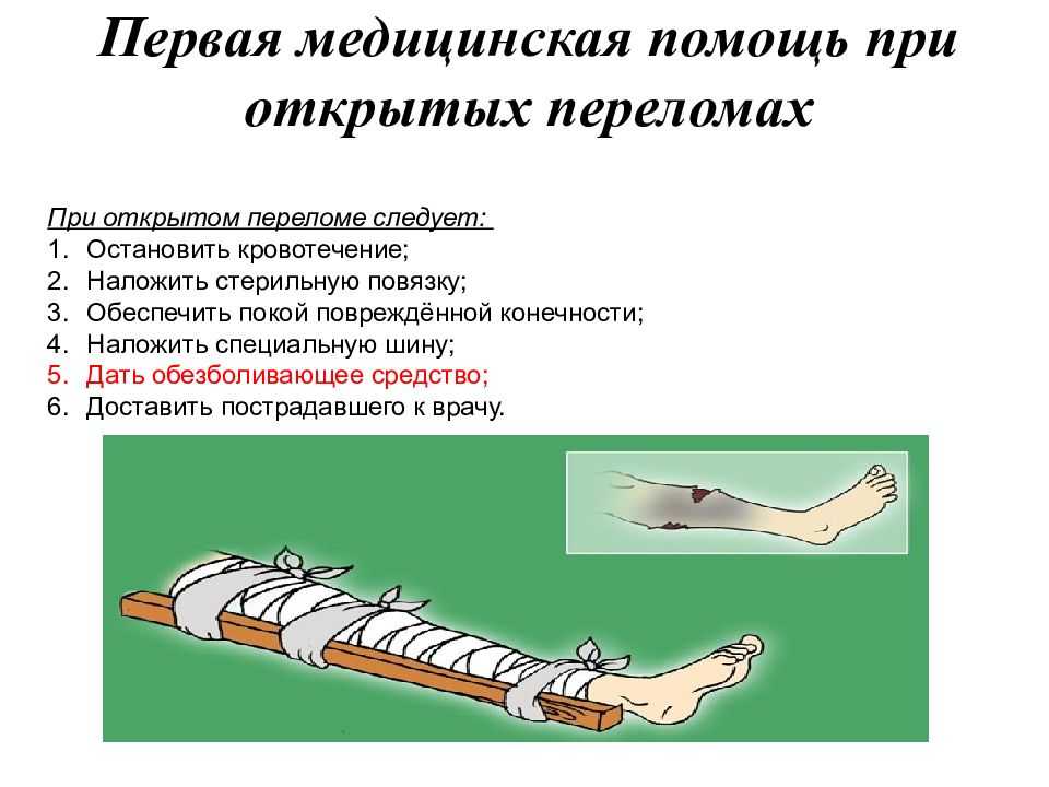 Рентгенологическая диагностика давности переломов ребер