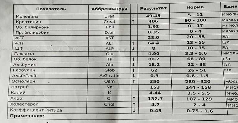 Какой креатинин должен у человека. Показатель креатинина в норме у мужчин. Расшифровка анализа крови креатинин норма. Мочевина и креатинин в крови норма. Биохим.АН.крови креатинин норма.