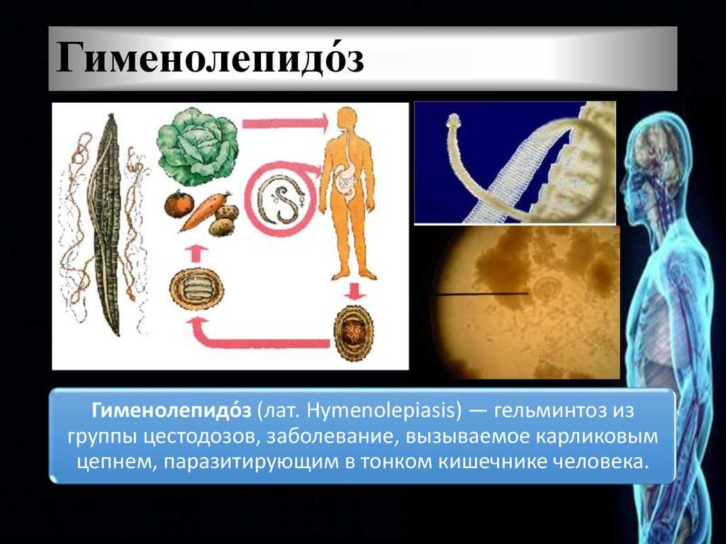 Гельминтозы: современный взгляд на проблему