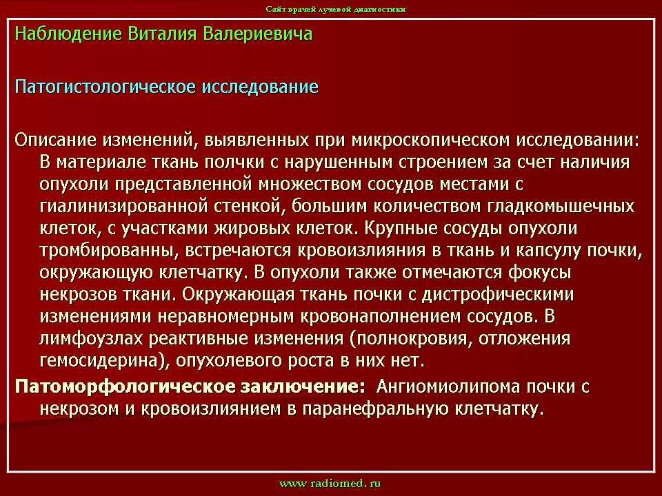 Новый подход к диагностике, иммунофенотипической верификации и прогнозу почечной ангиомиолипомы » библиотека врача