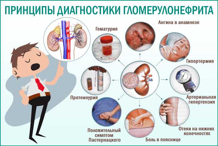 Диетическое  питание при пиелонефрите.