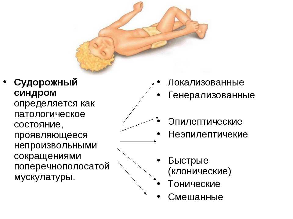Эпилепсия