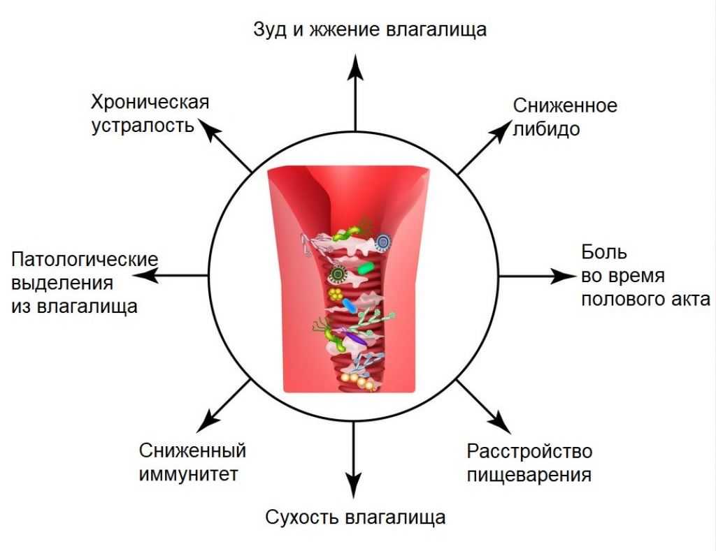 Кандидоз (молочница) — когда нестерпимо чешется