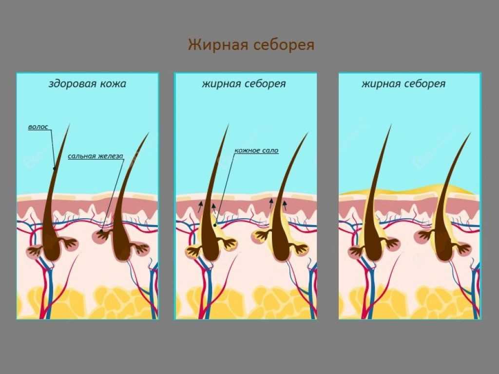 Строение кожи в деталях