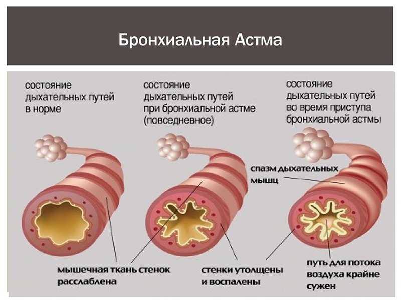 Гипоаллергенная диета: меню, продукты и блюда | food and health