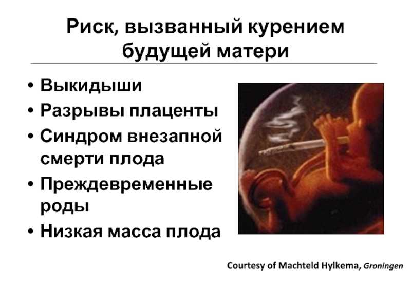 Антенатальная гибель плода