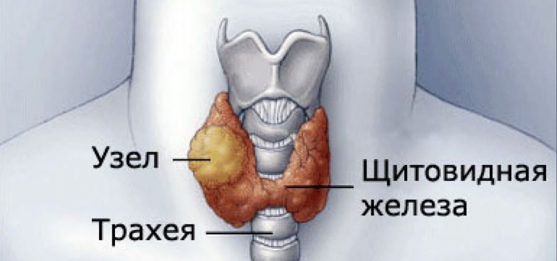 Психосоматика узлов щитовидной железы. Узел 5 мм в щитовидной железе. Увеличены узлы щитовидной.