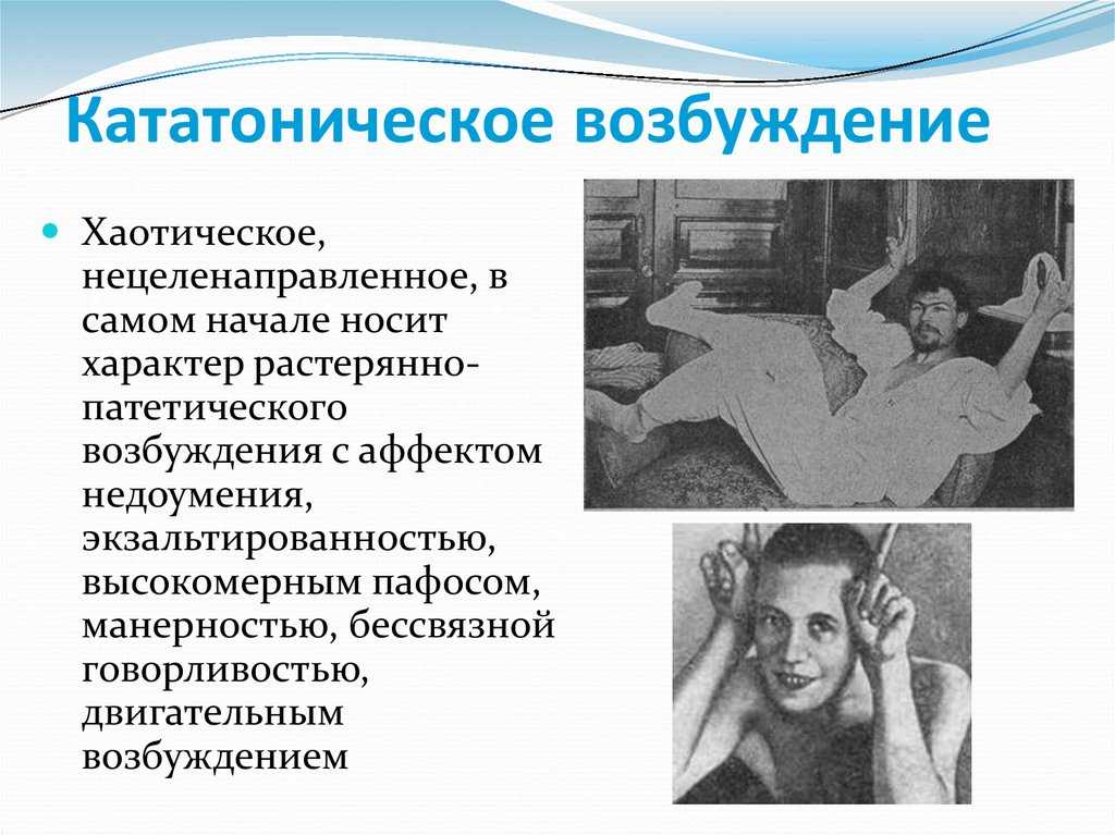 Симптомы кататонической формы шизофрении