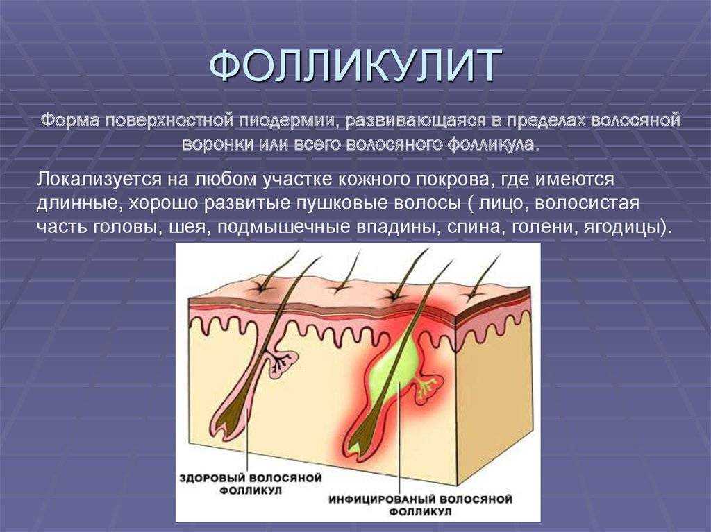 Заболевания кожи у детей | 1дмц