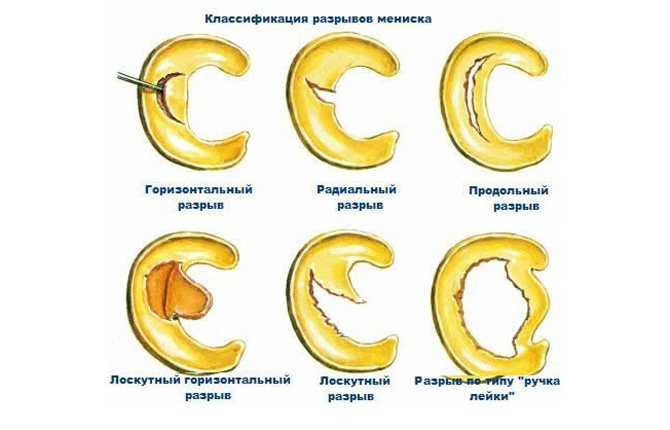 Диета для пожилых людей, меню питания | доктор борменталь