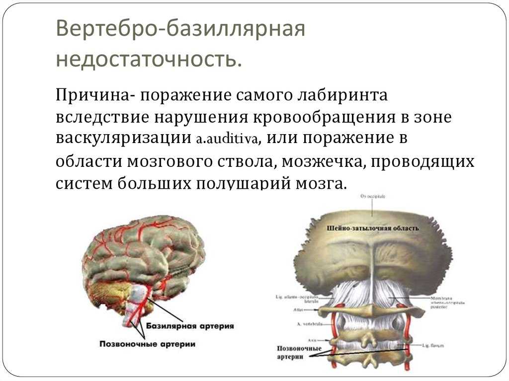 Вбн диагноз в неврологии что. Вертебро базилярная система головного мозга. Синдром хронической вертебробазилярной недостаточности. Синдром вертебробазилярной артериальной системы симптомы. Вертебробазилярная недостаточность кровоснабжения головного мозга.