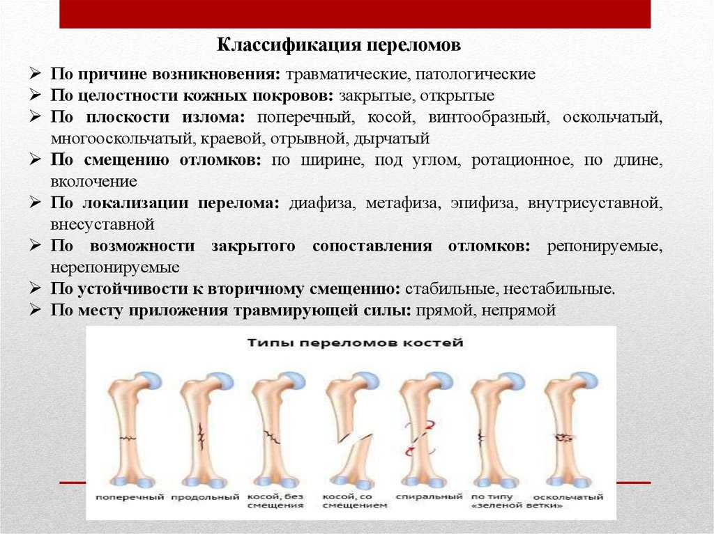 Первая медицинская помощь при переломах - официальный сайт администрации устьевого сельского поселения