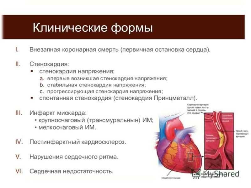 Шунтирование смертность. Шунтирование коронарных артерий сердца. Коронарное шунтирование операция. Аортокоронарное шунтирование (АКШ). Коронарная недостаточность и ИБС.