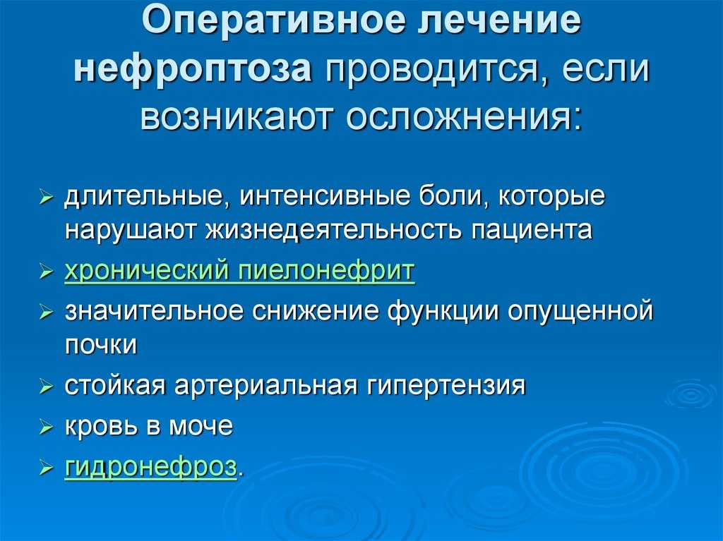 Нефроптоз (опущение почки)